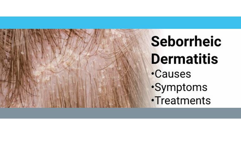 Seborrheic Dermatitis - familydoctor.org