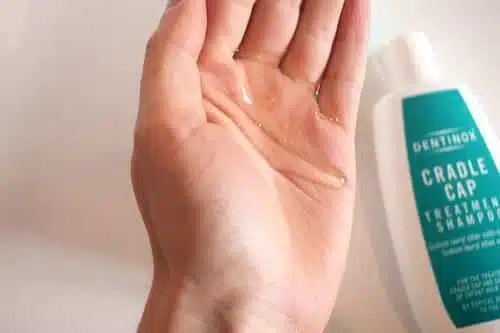 dentinox cradle cap shampoo for adults