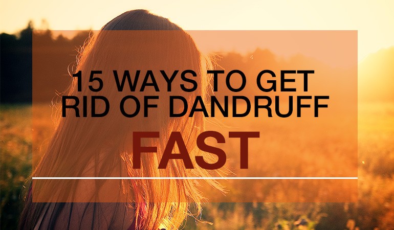 fastest ways to get rid of dandruff