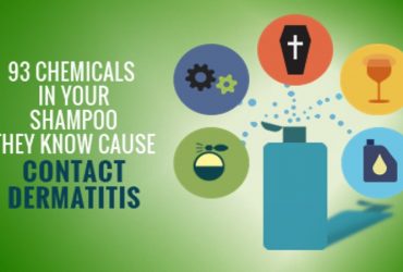 How To Treat Seborrheic Dermatitis  Dandruff Deconstructed